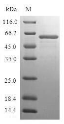 Human FBP1 protein