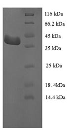 Human LRRFIP1 protein