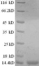 Human PSCA protein