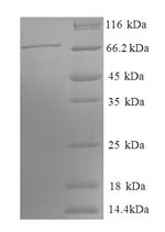 Human PGK1 protein