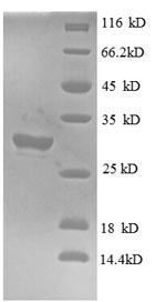 Human IFITM1 protein