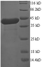Human ALG2 protein
