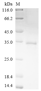 Human RORA protein