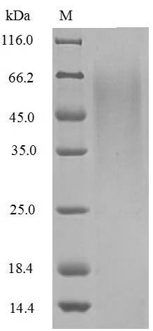 Influenza B virus Non-structural protein 1 protein