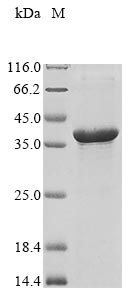 Human NSMCE3 protein