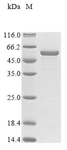 E. coli glmU protein