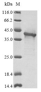 Human IFNK protein