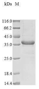 Mouse Aspdh protein