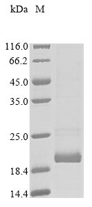 Human CCR4 protein