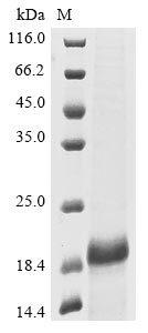 Mouse Mt3 protein