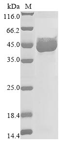 Paeniclostridium sordellii Sialidase protein