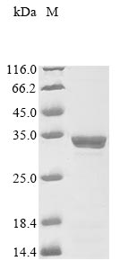 metapneumovirus Matrix protein protein