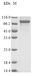 Human DYNC1I1 protein