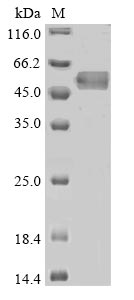 Human SERPINC1 protein