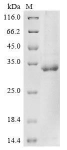 Human PARP9 protein