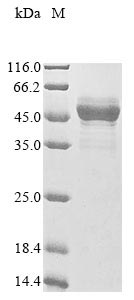 Paeniclostridium sordellii Sialidase protein