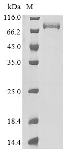 Paeniclostridium sordellii Sialidase protein