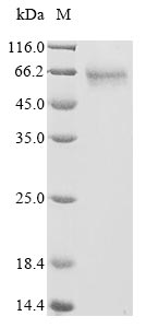Human SERPINC1 protein