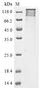 Human PADI2 protein