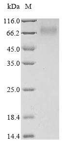 Human SERPINC1 protein