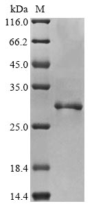 Human PYCARD protein