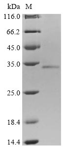 Human PARP9 protein