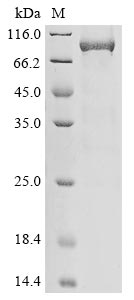 Human SERPINC1 protein