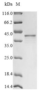 Human ZIC4 protein