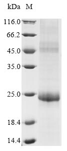 Human papillomavirus type 11 Replication protein E1 protein