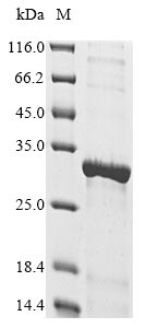 Rat Sirt3 protein