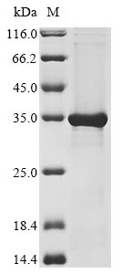 Human FBXO44 protein