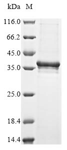 Vesicular stomatitis Indiana virus Matrix protein