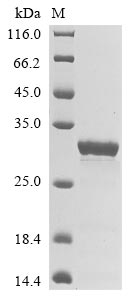 E. coli Escherichia phage lambda Capsid decoration protein