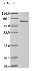 Human CCNB1 protein