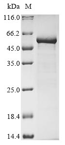 Vesicular stomatitis Indiana virus Nucleo protein