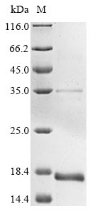 cytomegalovirus Envelope glycoprotein B protein