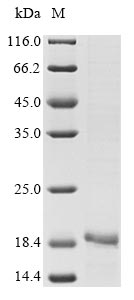 Bothrops jararaca Zinc metalloproteinase-disintegrin-like botrocetin protein