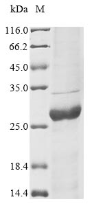 Human GART protein