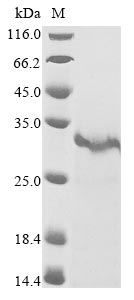Crotalus atrox Snake venom serine protease catroxase-2 protein