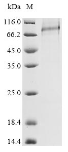 Human Acrosin protein