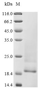 distemper virus Nucleo protein