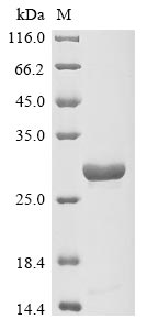 Chlamydia trachomatis Virulence plasmid protein pGP3-D protein