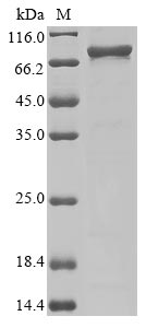 Human TREX1 protein
