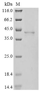 Human MACROD1 protein