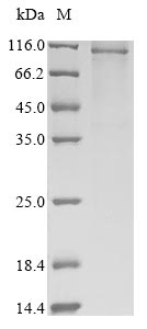 Human PLG protein