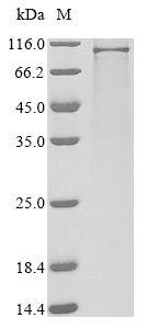 Human T114M protein