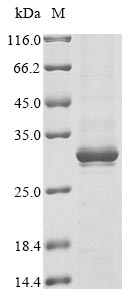 Human ALPK1 protein