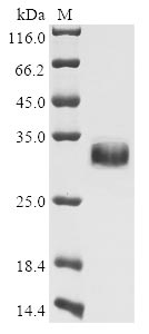 Human NOTCH2NLB protein