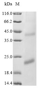 herpesvirus 6A Glycoprotein U22 protein