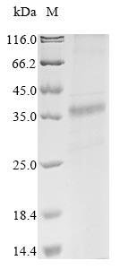 Mouse Hfe protein